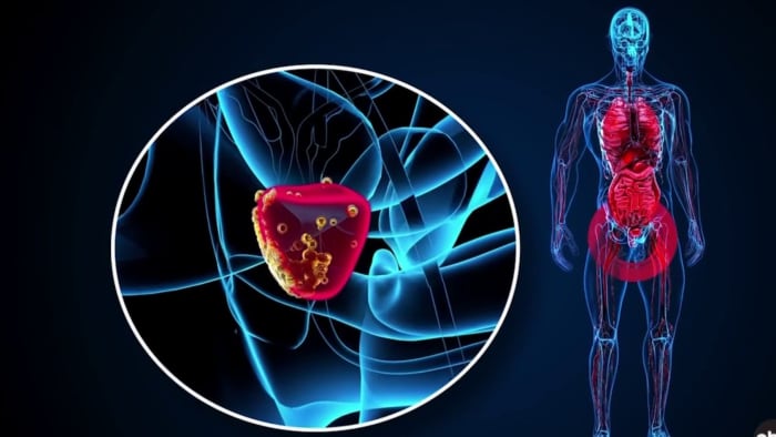 De dokter uit San Antonio wil een einde maken aan het stigma rond prostaatonderzoeken en moedigt mannen aan zich te laten onderzoeken