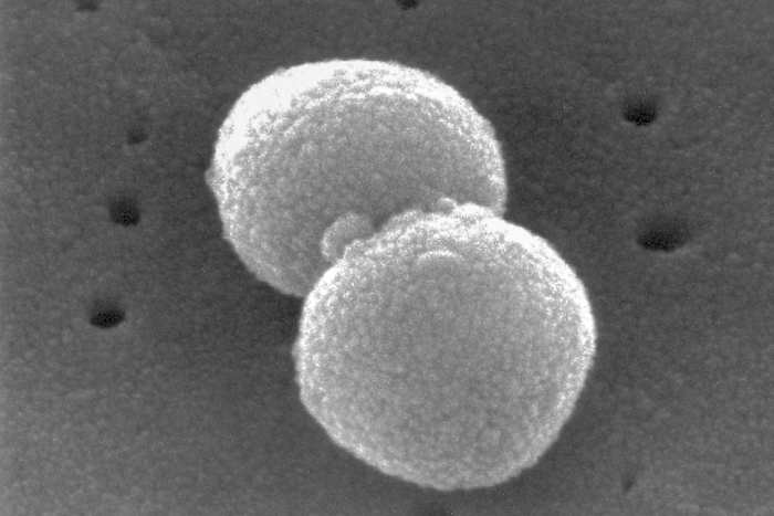 Dit elektronenmicroscopische beeld, verstrekt door de Centers for Disease Control and Prevention, toont twee ronde, Gram-positieve Streptococcus pneumoniae-bacteriën. (Janice Haney Carr/CDC via AP)