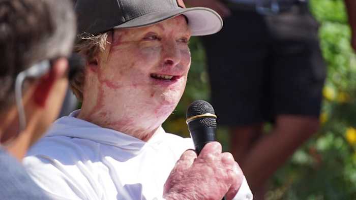 Overlevende van de brand in een appartement in San Marcos gebruikt een inspirerende houding om anderen te helpen