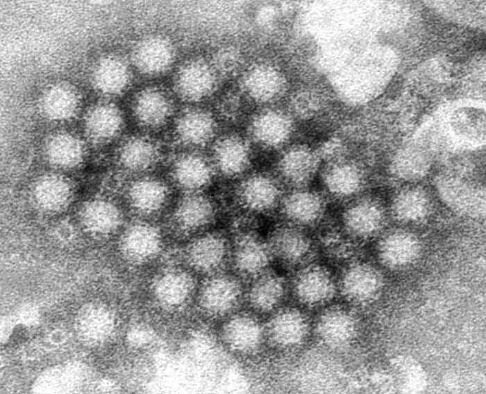 Het vervelende norovirus is weer op volle kracht nu het aantal gevallen van het maagvirus in de VS toeneemt