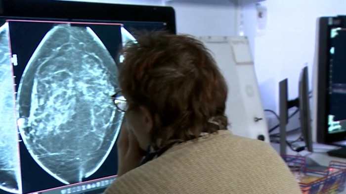 Toonaangevende borstkankerexperts komen samen en delen onderzoek in het Henry B. Gonzalez Convention Center