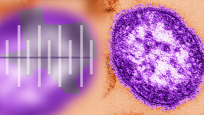 Tijdlijn: uitbraak van mazelen in West -Texas, potentiële blootstelling in Bexar County