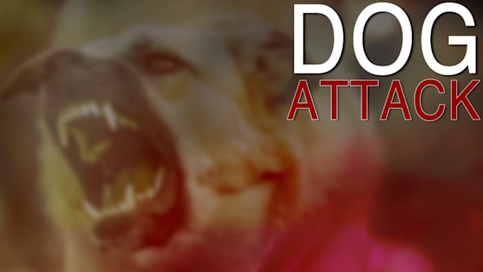 Vrouw meegenomen naar het ziekenhuis na een hondenaanval op de noordkant, zegt de politie