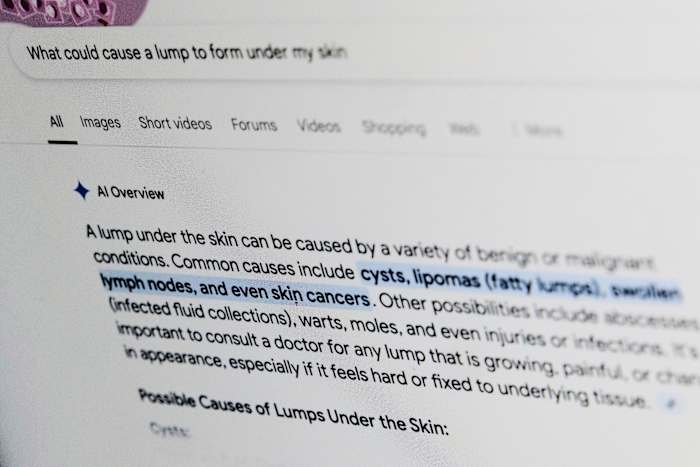 Wat is dat uitslag? Zet erover na om Google om medische hulp te vragen