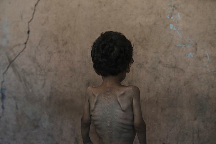 De leider van Israël beweert dat niemand in Gaza honger is. Gegevens en getuigen zijn het er niet mee eens