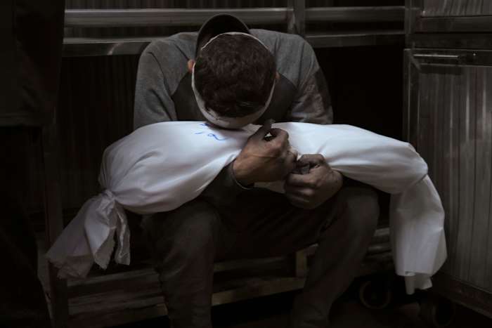 VN zegt dat ondervoeding in Gaza is verdubbeld, omdat gezondheidsfunctionarissen zeggen dat Israëlische stakingen meer dan 90 mensen doden