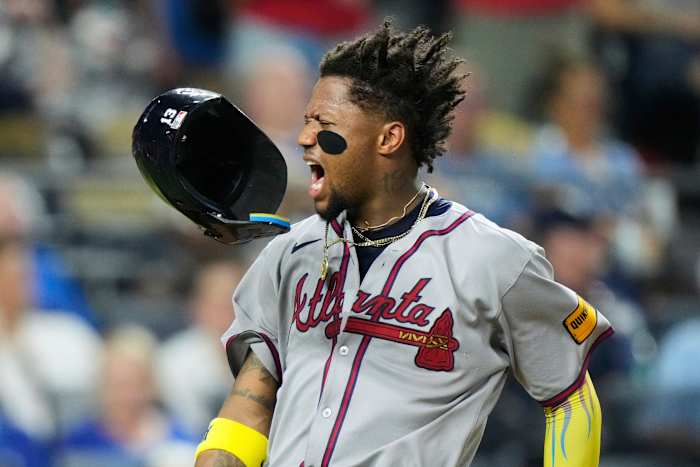 Braves plaatsen 5-keer All-Star Ronald Acuña Jr. op de gewonde lijst met Achilles peesontsteking