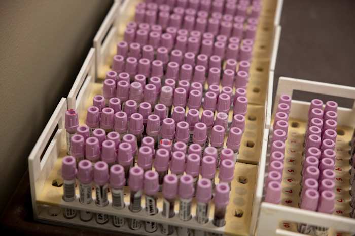 Staatsgezondheidsfunctionarissen verklaren de uitbraak van West Texas mazelen over