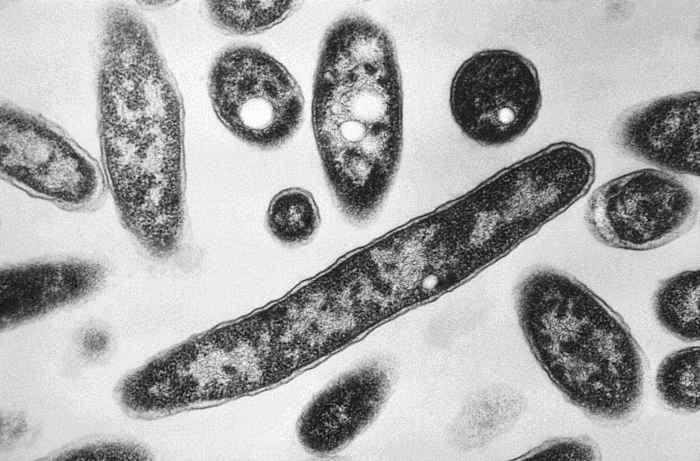 Wat te weten over de ziekte van Legionnaires, die tientallen ziektes heeft ziek in New York City