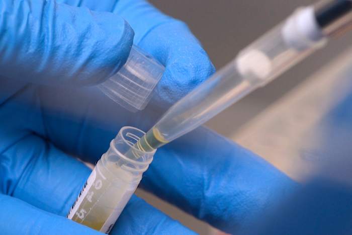 Bezuinigingen op de NIH-financiering hebben meer dan 74.000 mensen getroffen die deelnamen aan experimenten, aldus een nieuw rapport