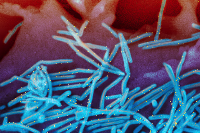 Het wintervirusseizoen valt tot nu toe mee, maar artsen maken zich zorgen over het komende lijden