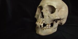 Oude tanden uit Siberië herschrijven de tijdlijn van de pest, die teruggaat tot meer dan 5500 jaar geleden