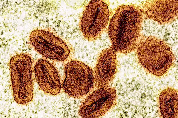 Twee wetenschappers worden ervan beschuldigd het gedeactiveerde mpox-virus naar de VS te hebben gebracht en te hebben gelogen tegen de autoriteiten