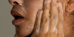 Acne bij volwassenen bestaat echt, maar er zijn manieren om het te behandelen. Dit is wat u moet weten