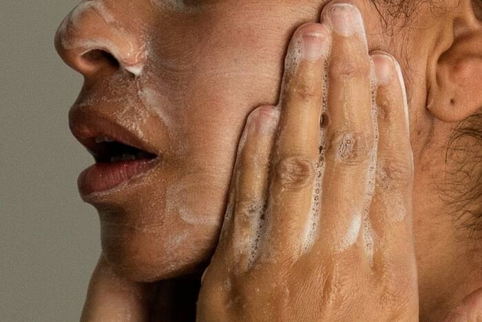 Acne bij volwassenen bestaat echt, maar er zijn manieren om het te behandelen. Dit is wat u moet weten