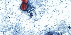Cyclospora gevonden op Mexicaanse boerderij in verband met sla-uitbraak, zegt de FDA